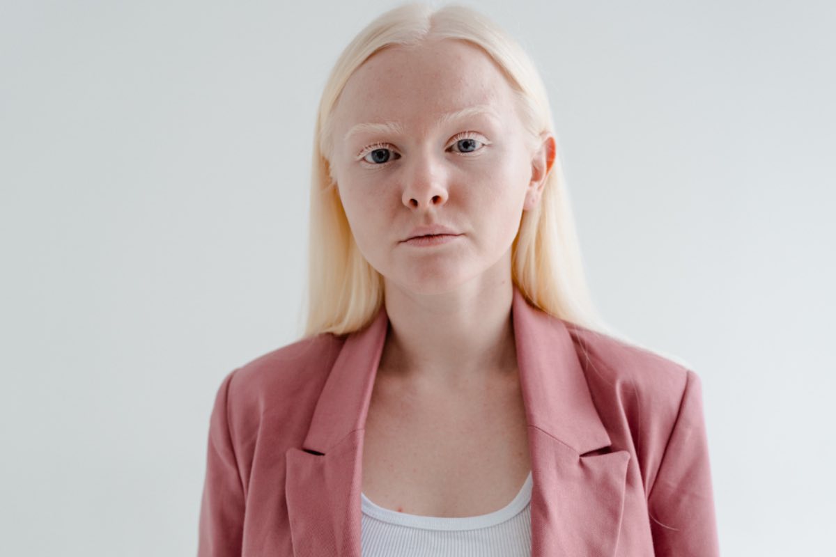 pelle albina armocromia